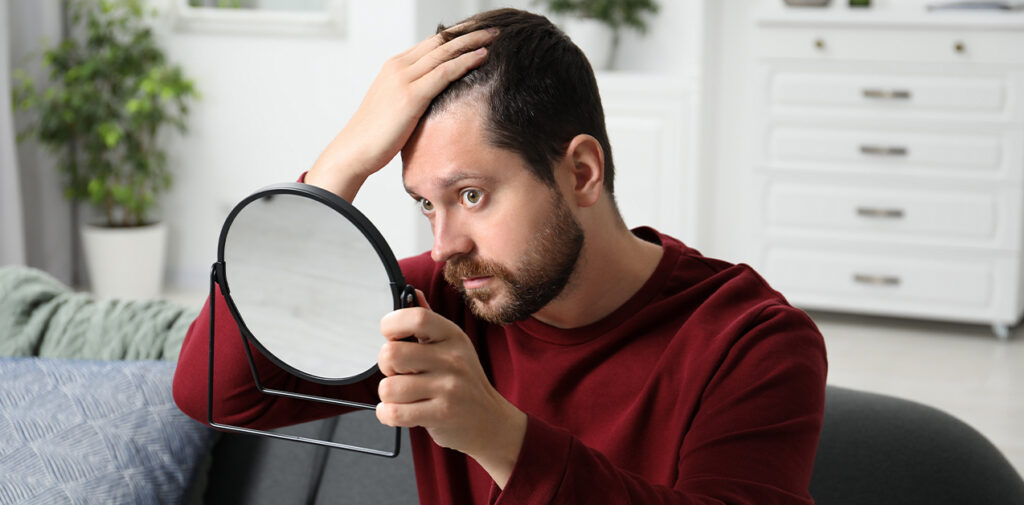 Man looking at hairline in mirror